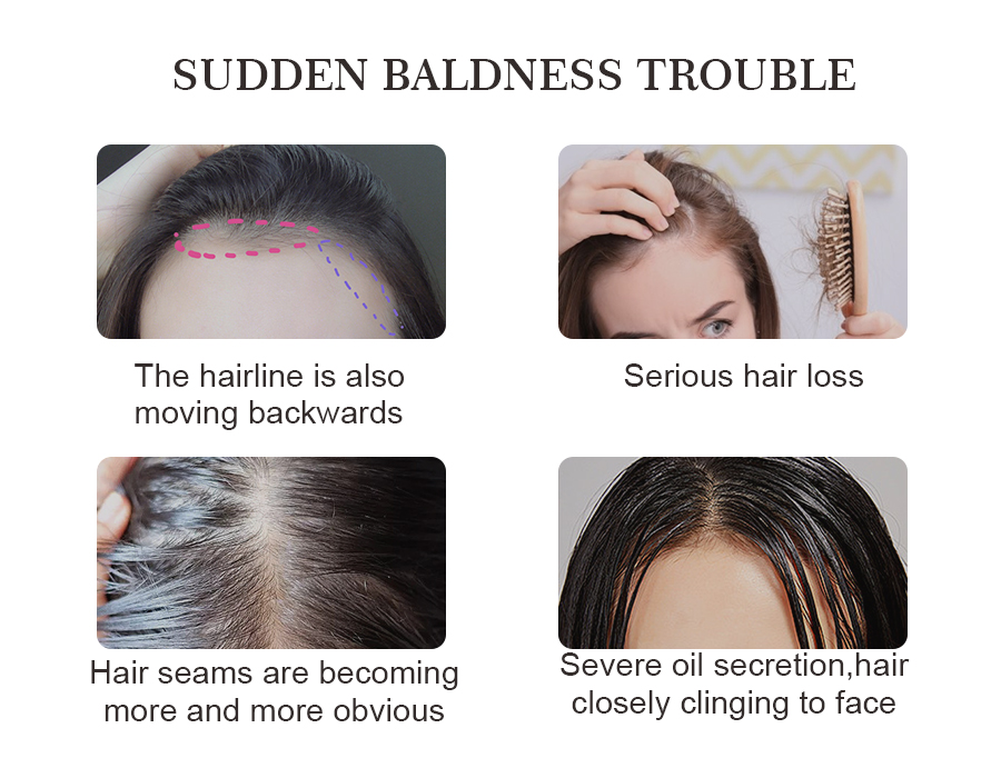 密發防掉蓬松頭皮精華液—主圖（英文版）4